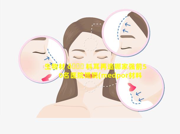 生物材 🐈 料耳再造哪家强前50名医院揭晓(medpor材料进行耳再造)